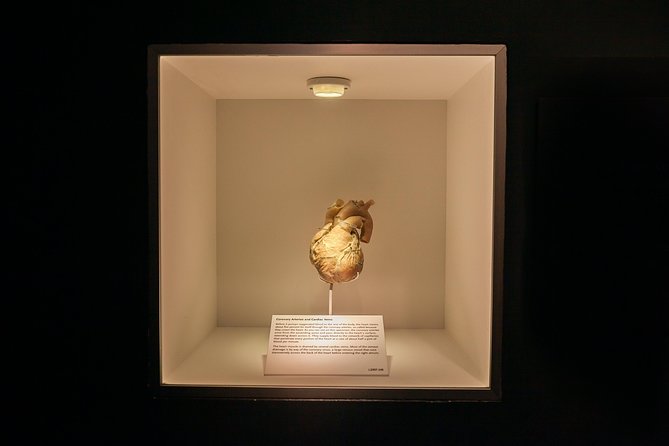 Bodies The Exhibition at the Luxor Hotel and Casino - How graphic is it, really? Family questions and good judgment